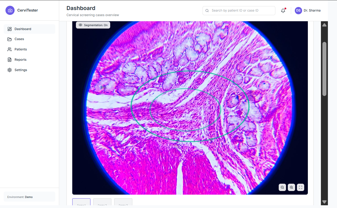 CerviTester – Screening Backend preview
